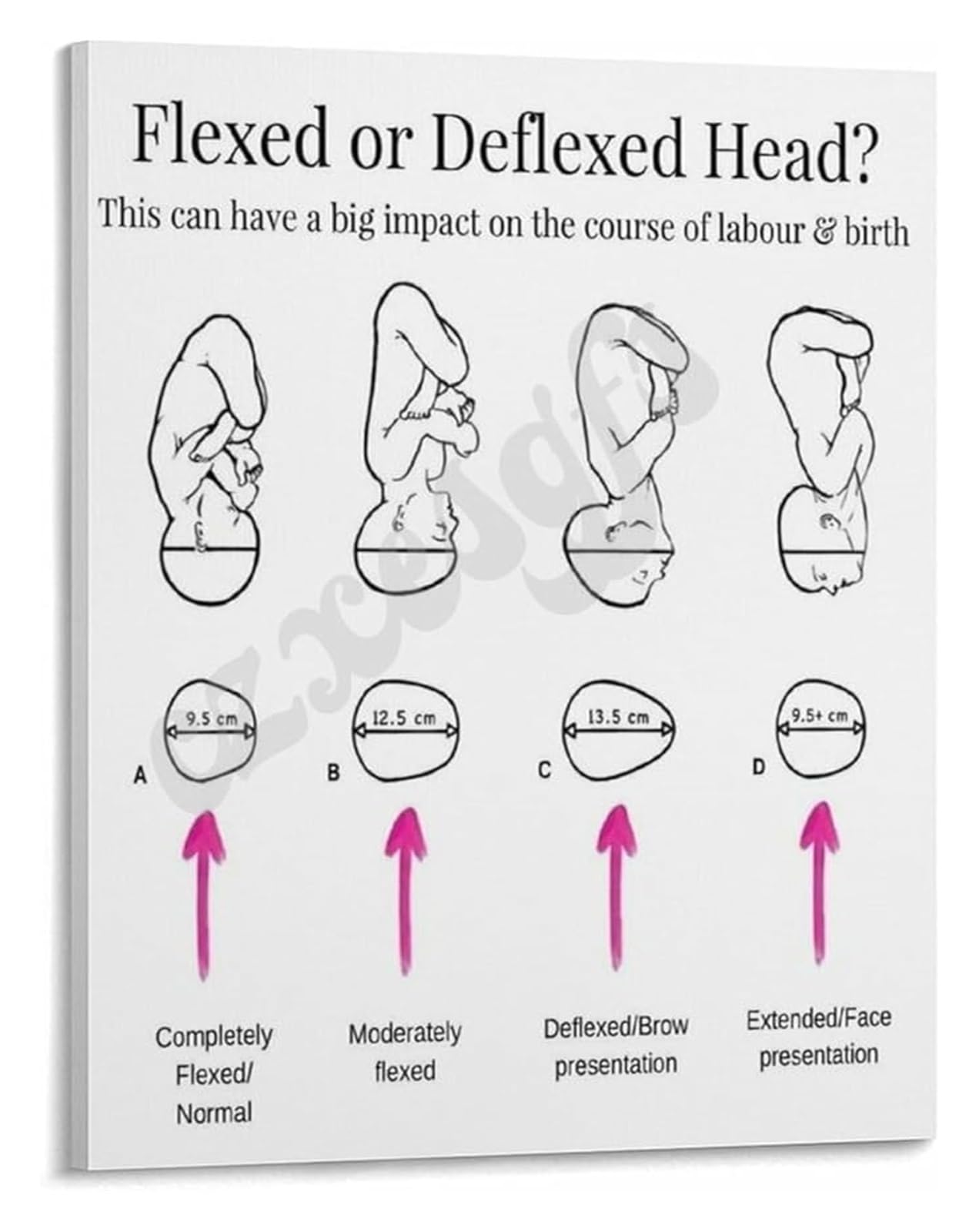 REIUAFWYGV Labor Progress Chart Poster Fetal Head Position Changes During Birth for Doulas and Childbirth Classes(Unframed,16x24inch(40x60cm))