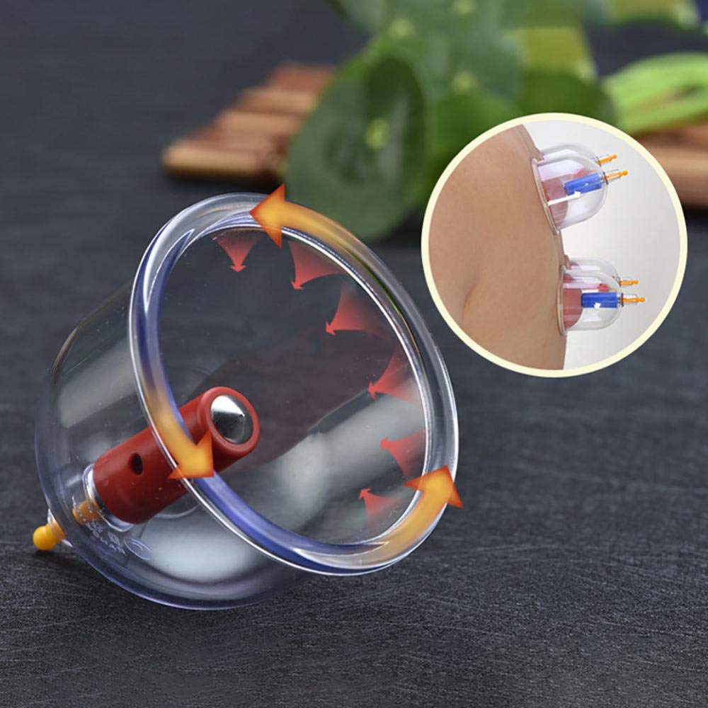 FOOJo 24-Cup-Vakuum-Schröpfset, professionelle chinesische Schröpftherapie, traditionelles chinesisches Schröpf-Massage-Set