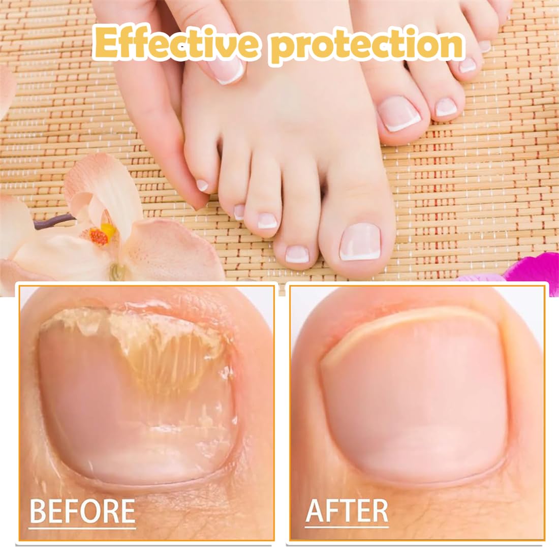 1 PCS Spray Soin des Ongles 100 ml - Pour protéger les ongles, renforcer les cuticules, réparer les ong-les,Sérum Ong-les et Pédicure,spray defense.