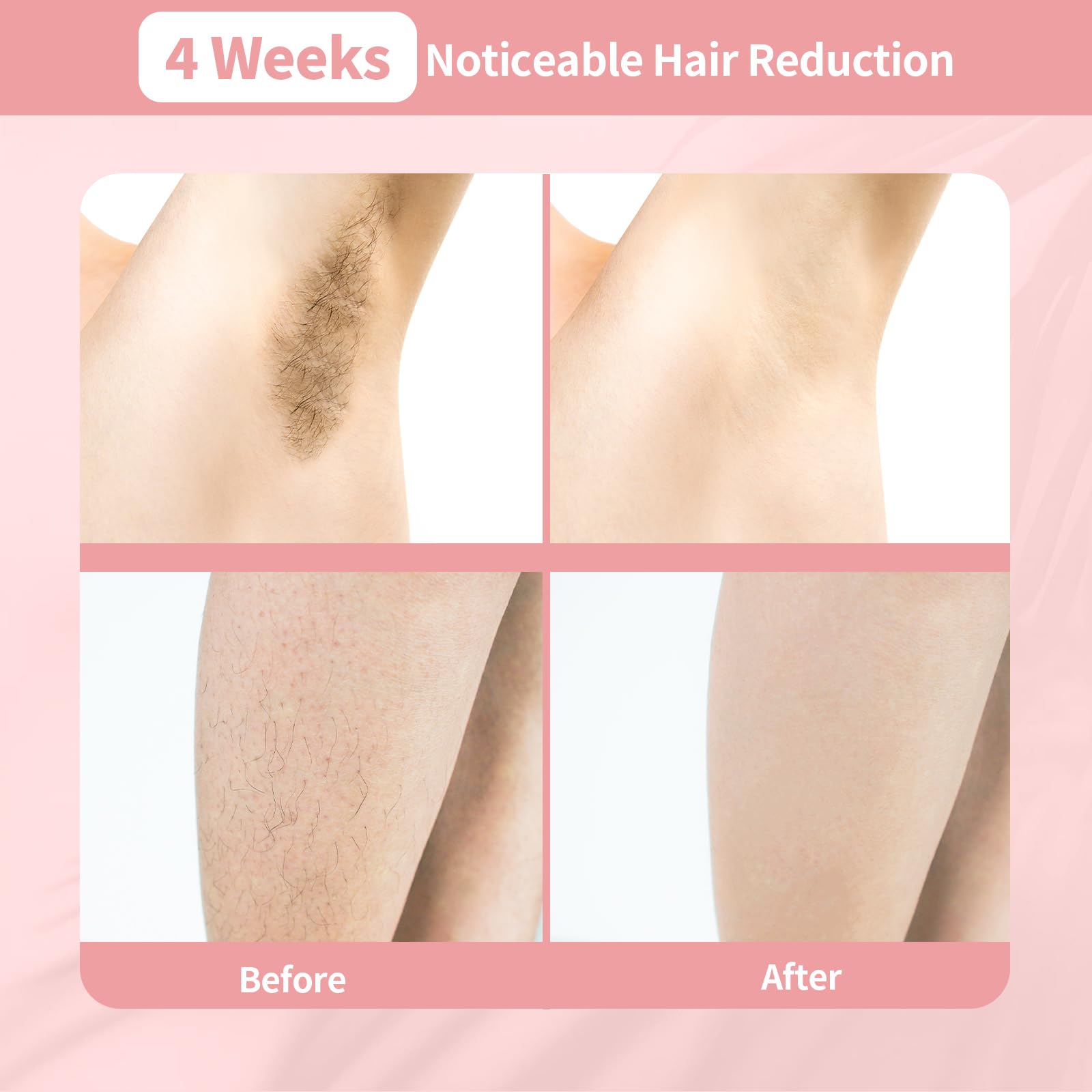 Épilation Laser pour Femmes et Hommes, Appareil D'épilation IPL 3 en 1 pour Tout le Corps, Indolore, Sûr, Convient aux Salons de Beauté, Aux Spas et à L'utilisation à Domicile