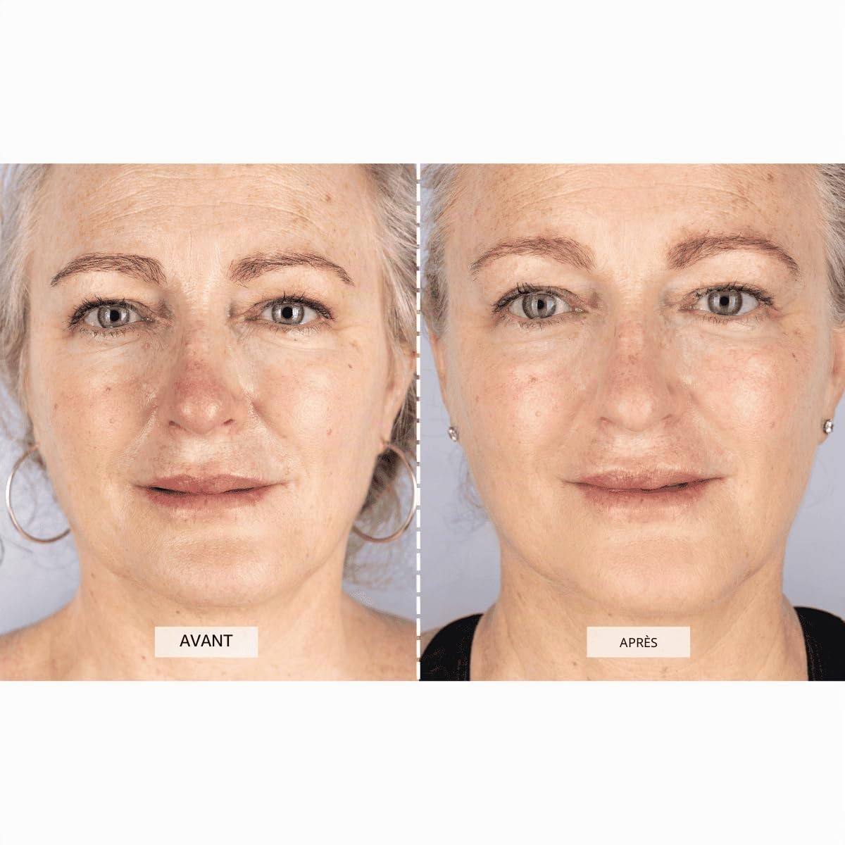 CurrentBody Masque facial de thérapie par lumière LED : série 1 | Dispositif de traitement par la lumière rouge | Masque facial anti-âge pour réduire les rides