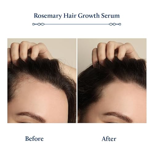 Miniatura 5 de Blue Nectar Suero para el crecimiento del cabello con aceite de romero para el crecimiento del cabello | Aerosol tónico ayurvédico para el cabello