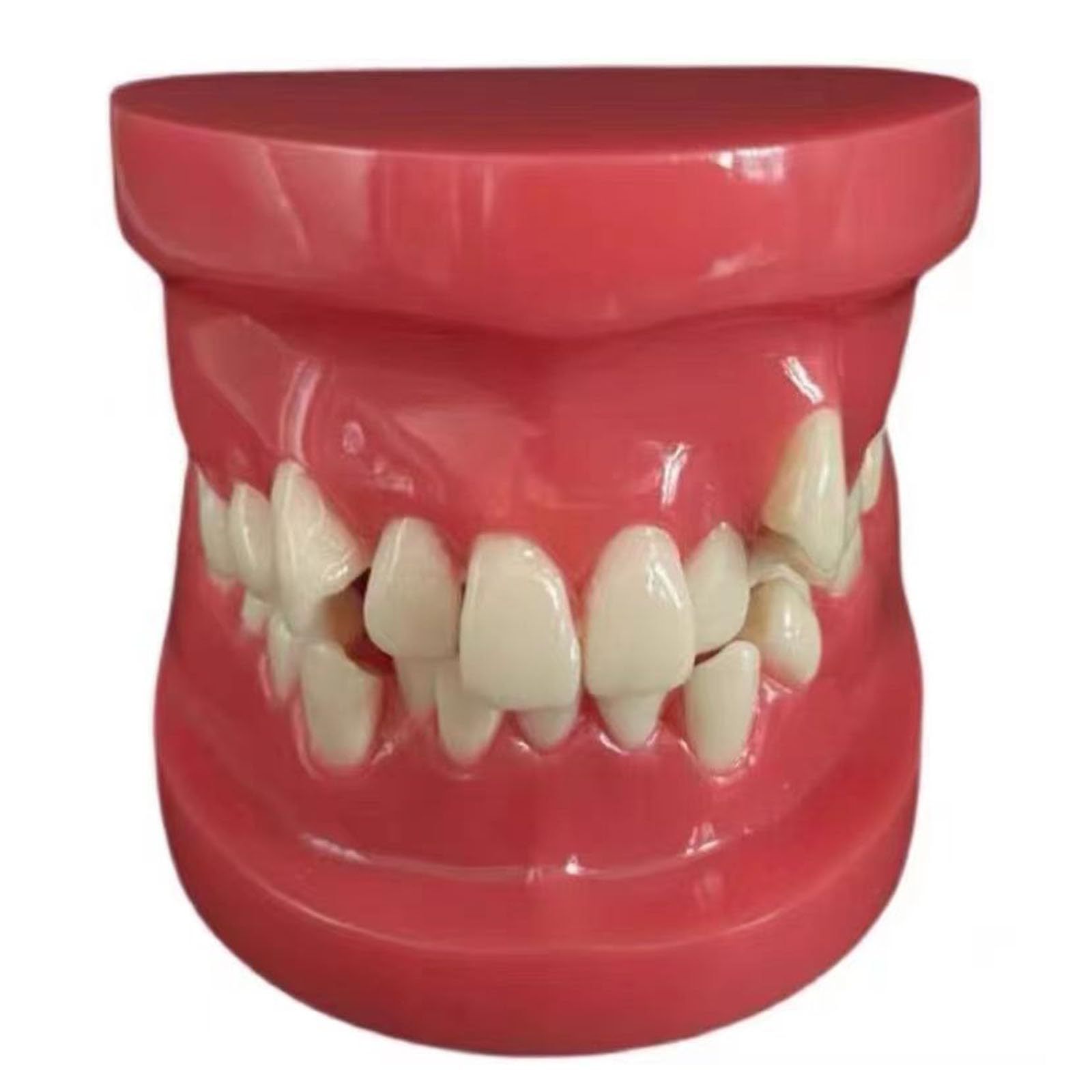 Kieferorthopädisches Demonstrationsmodell - Typodonten Kieferorthopädisches Demonstrationsmodell - Ideal für Bildungs- und Ausbildungszwecke,A,8cm