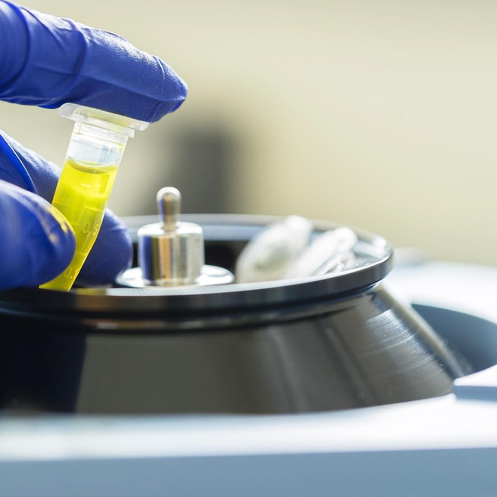 DAJAVE 1000 Stück Zentrifugenröhrchen 1,5 ml Reaktionsgefäße Durchsichtiges Mikrozentrifugenröhrchen aus Kunststoff, Probenröhrchen Zentrifuge Reagenzgläser Lagerung Vial mit Snap (1000PCS-1,5ML)