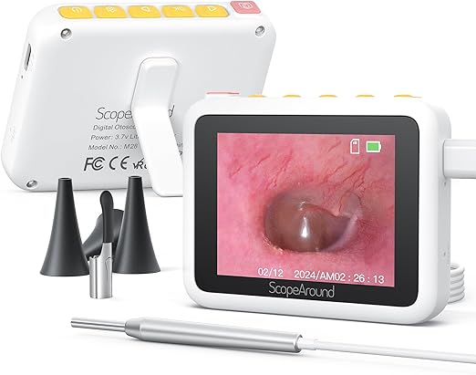 ScopeAround Otoscope with Light, 3.9mm Ultra-Thin HD Smart Visual Ear Camera, Digital Otoscope for Kids and Adults, Plug & Play Ear Wax Removal Tool Camera for Home Ear Inspection(White)