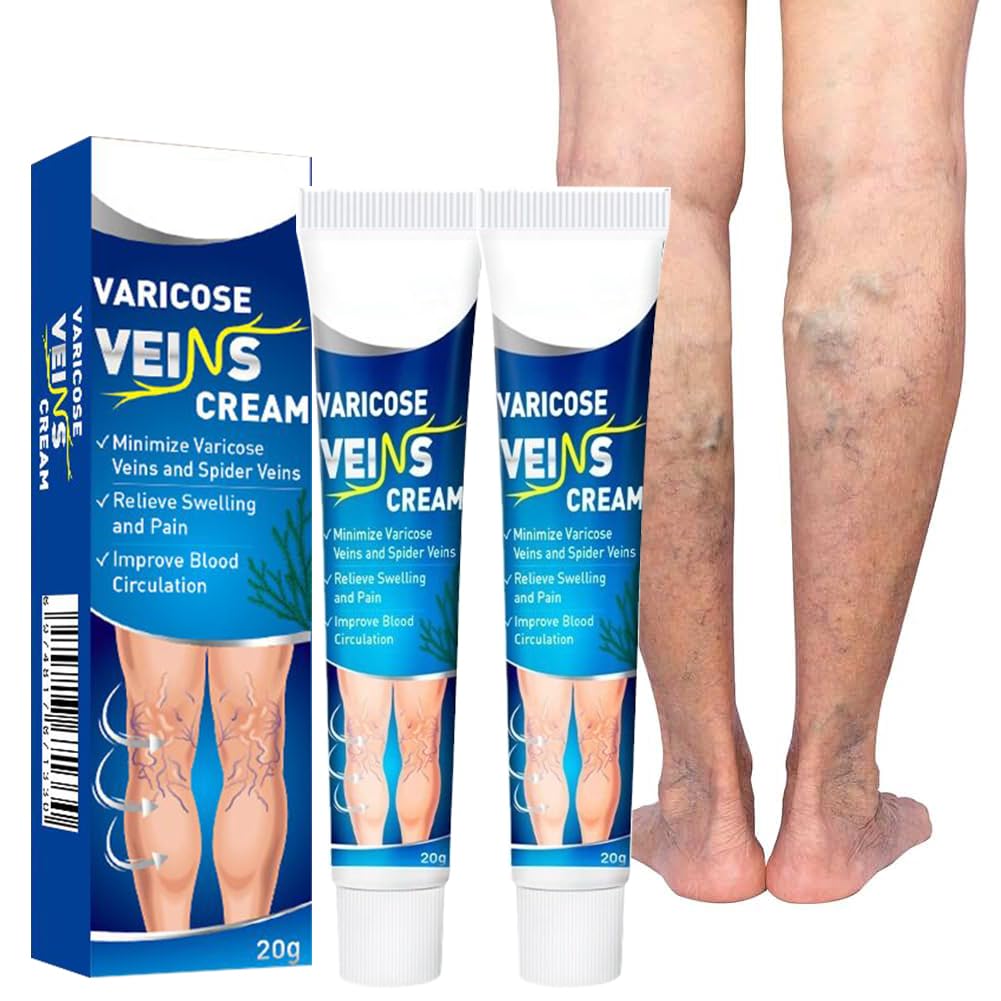 Crema per Vene Varicose,2pc 20g Crema per Vene Varicose Gambe,Cremas Lenitiva per Gambe,Cremas Venes Varicose e Capillari