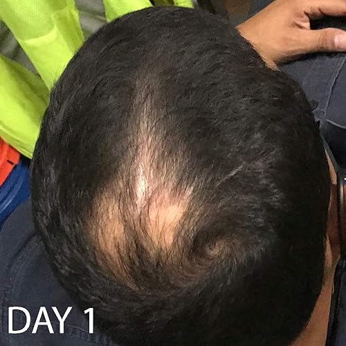 Miniatura 6 de Acondicionador de crecimiento del cabello de la vitamina de la biotina-(alta potencia) acondicionador de biotina para el crecimiento más rápido del