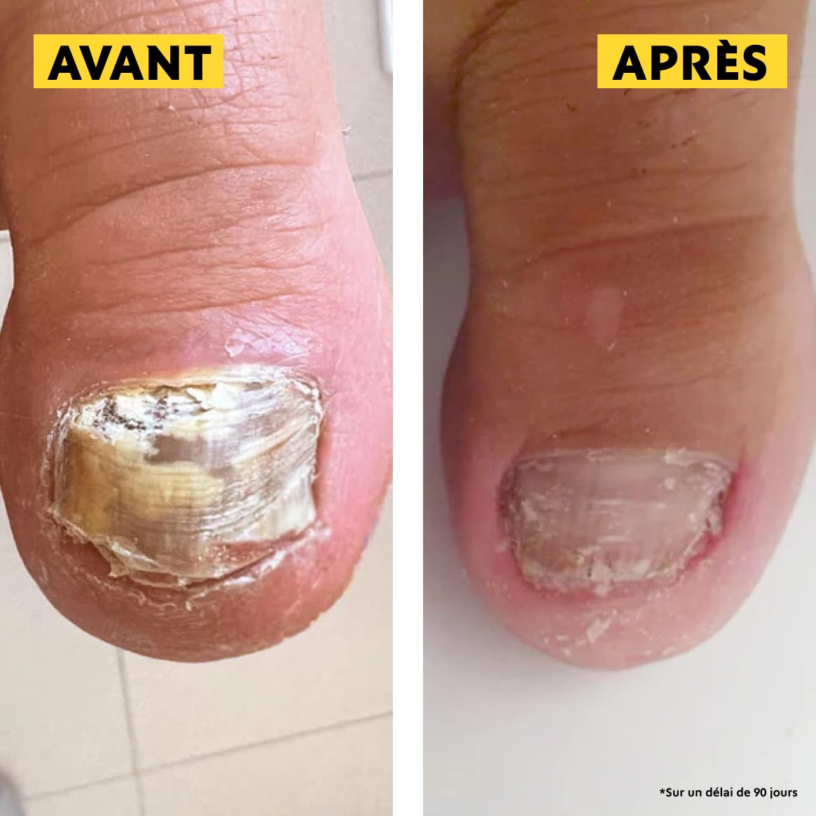 Alvadiem | Soin Ongles Assainissant Réparateur Ongles Jaunis Abîmés | Purifie, Renforce et Restaure la Couleur | Propolis Noire des Cévennes, Terpinéol | Fabriqué en France, 99% Naturel | 10 ml