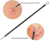Vista 5 de Kit de herramientas para eliminar espinillas, 4 piezas, herramienta extractor de espinillas para nariz y cara, juego de herramientas de eliminación