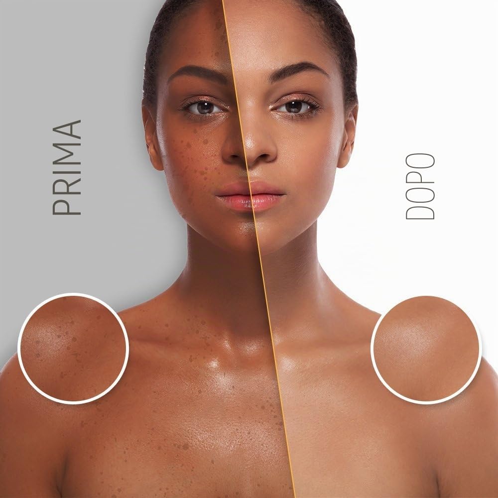Latte Corpo Rischiarante CLassic Makari [140ml] - Lozione Corpo Rischiarante e Idratante con Vegeclairine™ - Trattamento rischiarante per Macchie Scure, Cicatrici da Acne e Smagliature