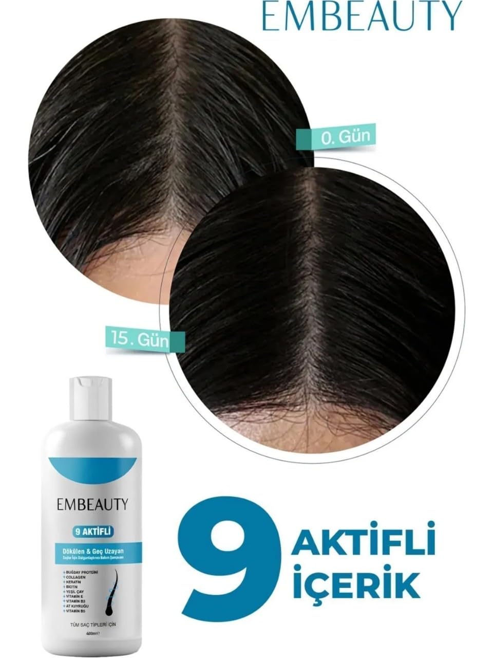 Kolajen ve Keratin Saç Dökülmesine Karşı Hızlı Sac Uzatan Dolgunlaştırıcı Onarıcı Besleyici Şampuan