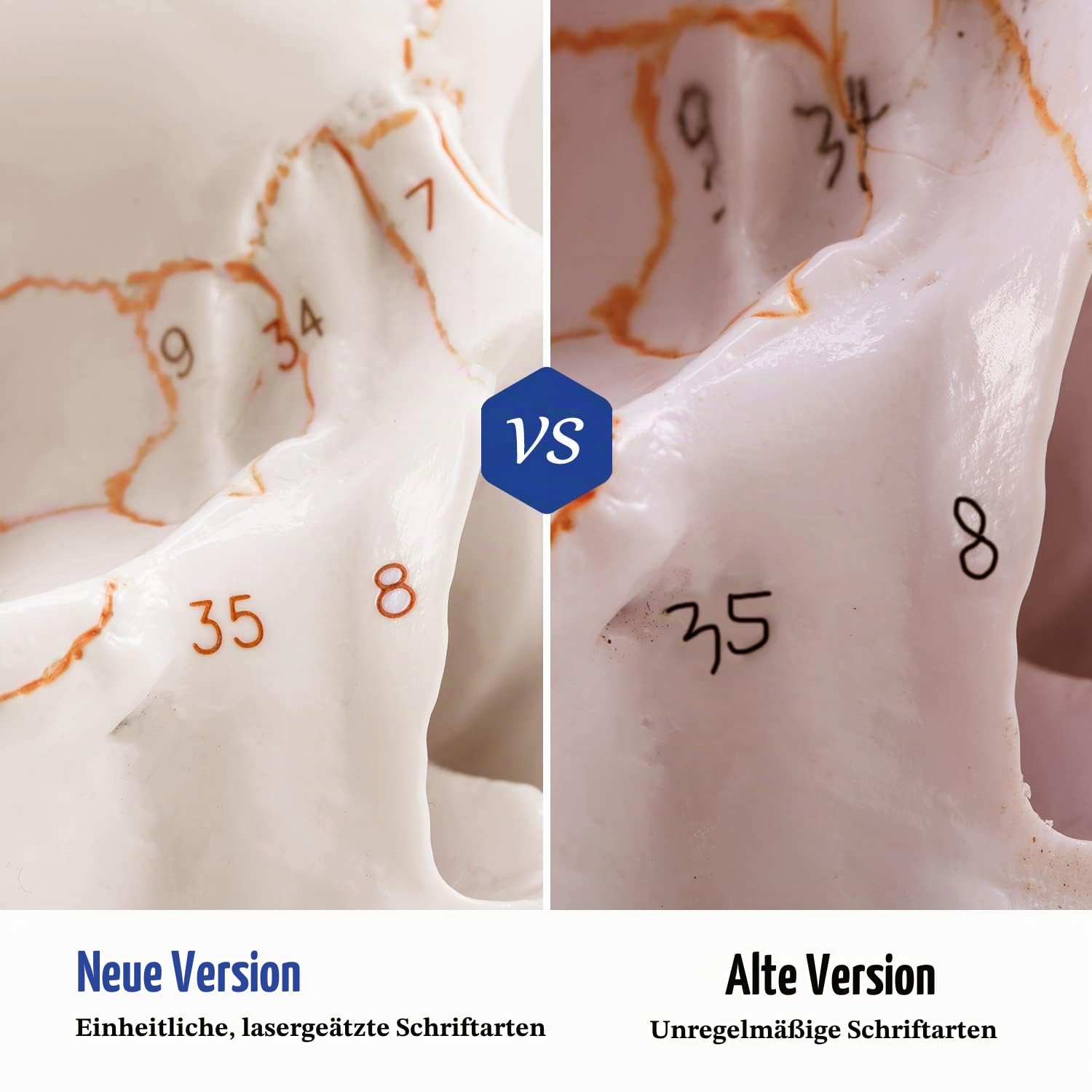 Medarchitect Schädel Modell, Lebensgroßes Anatomisches Modell Des Menschlichen Schädels, Neuster Lasertechnik Beschriftet, Nicht Handbeschrieben, Ohne Verschmieren, Medizinstudenten Und Anatomiekurse