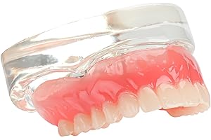Dental Implant Upper Overdenture Study Model