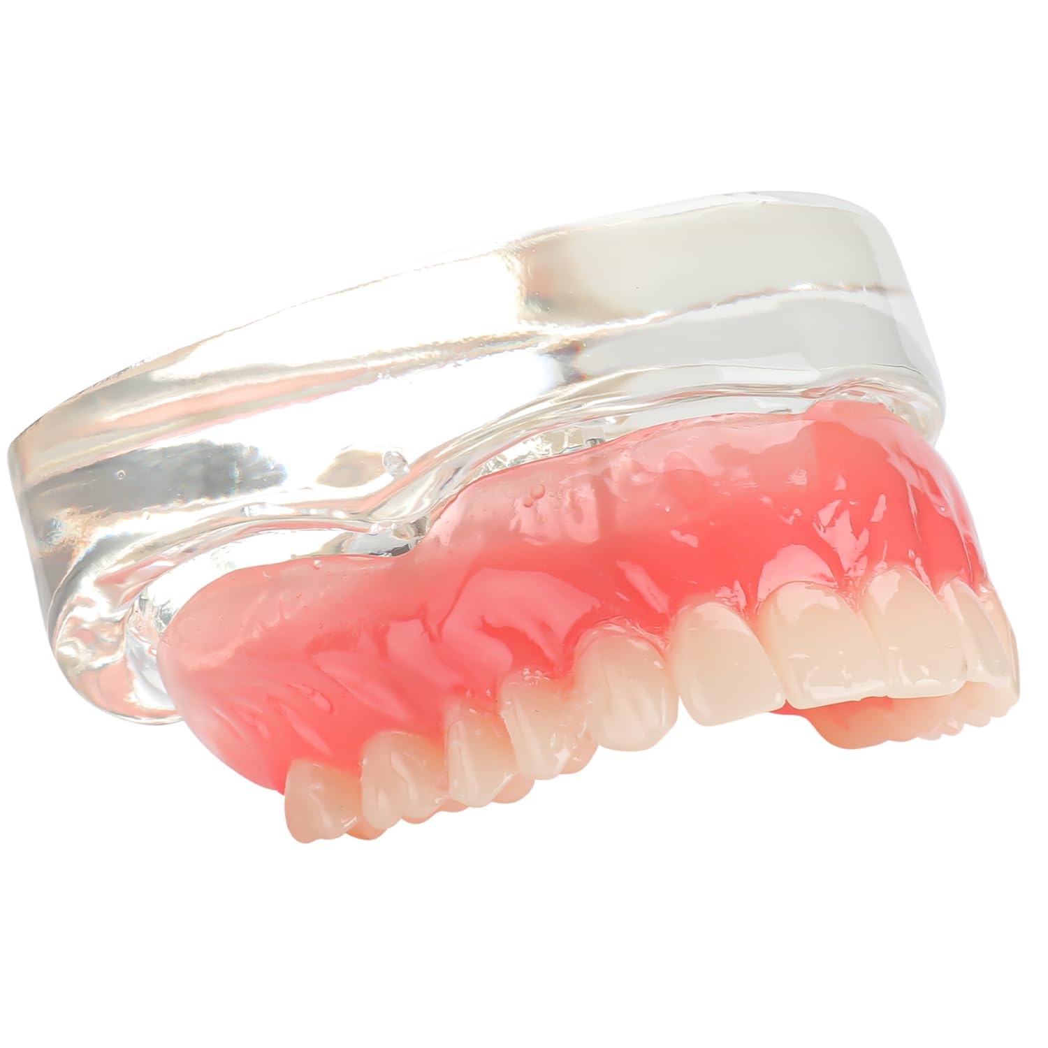 Upper Overdenture Model - Dental Implant Overdenture Model,Denture Model with Implants for Teaching and Studying