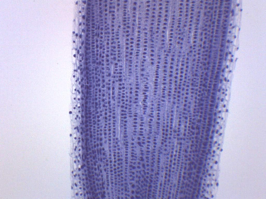 EISCO 10PK Allium Root Tips, Mitosis - Prepared Microscope Slides - Classroom Pack, 10 Slides in Storage Case - Biology & Microscopy