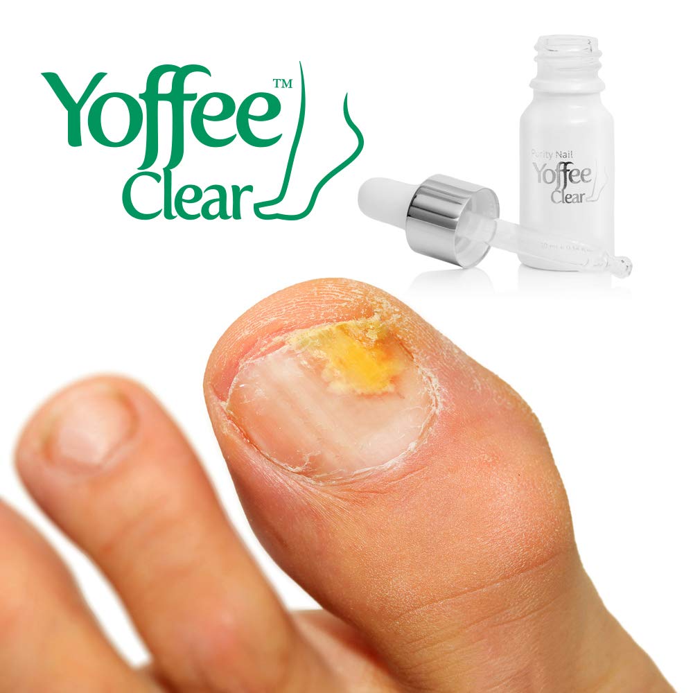 Buy Yoffee Clear Nail Care Anti Fungal Nail Treatment for Finger and Toenails 10 ml