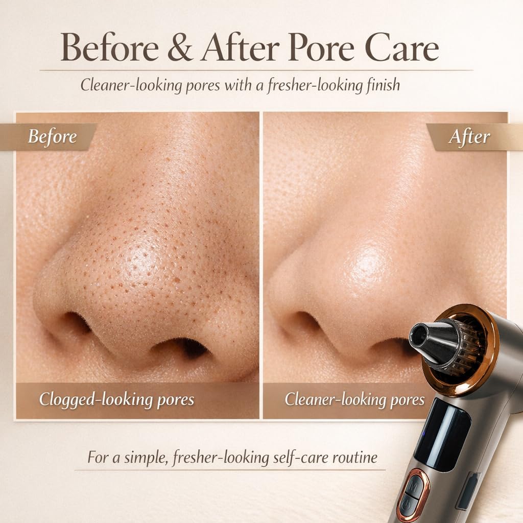 Blackhead Remover Pore Vacuum with Heating, 3 Suction Levels, 5 Suction Heads, LED Display, USB Rechargeable Blackhead Extractor for Women & Men