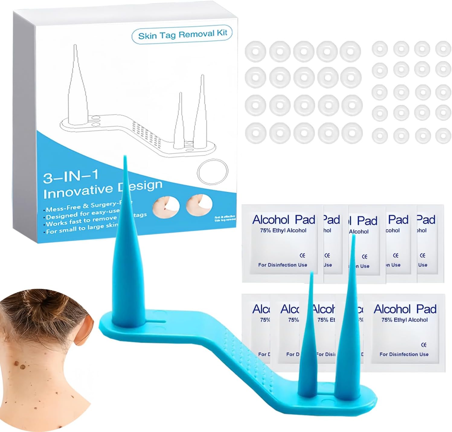 50 pcs Skin tag remover,Excilor acrochordons,Acrochordons,(2mm to 8mm) 3 en 1 Auto skin tag 50 pcs Skin tag remover,Excilor acrochordons,Acrochordons,(2mm to 8mm) 3 en 1 Auto skin tag