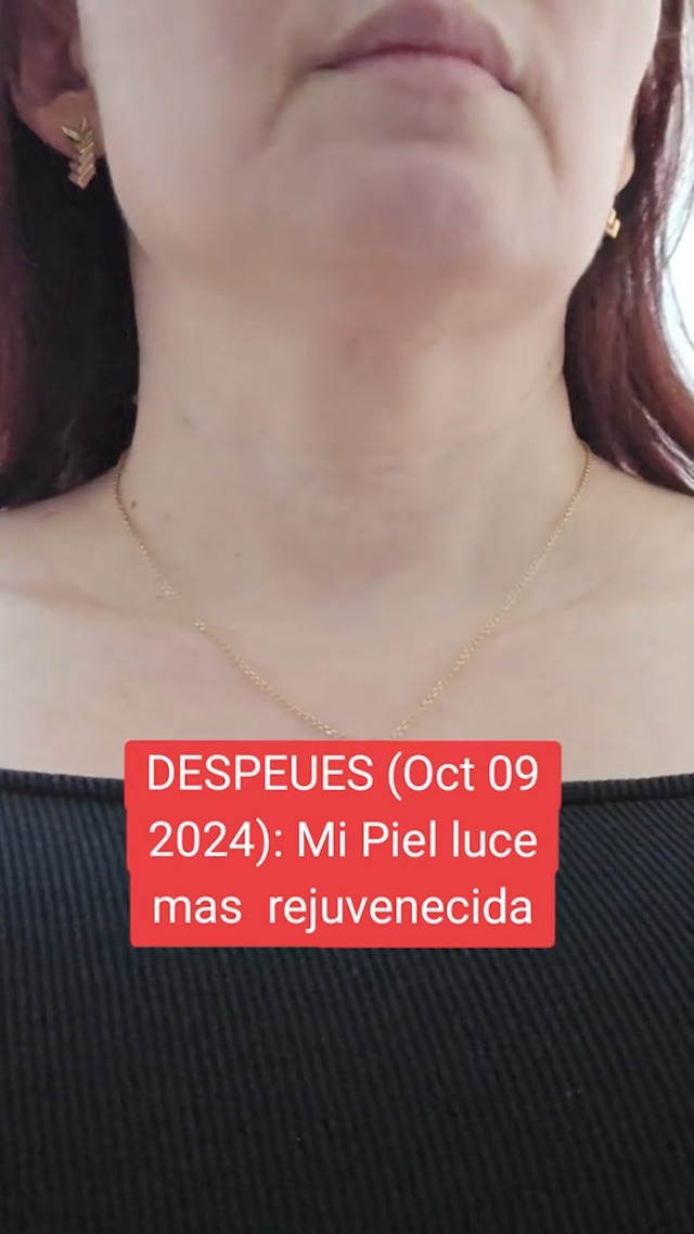 Amazon.com: ZIXAOK Neck Creams for Tightening and Firming-Instant