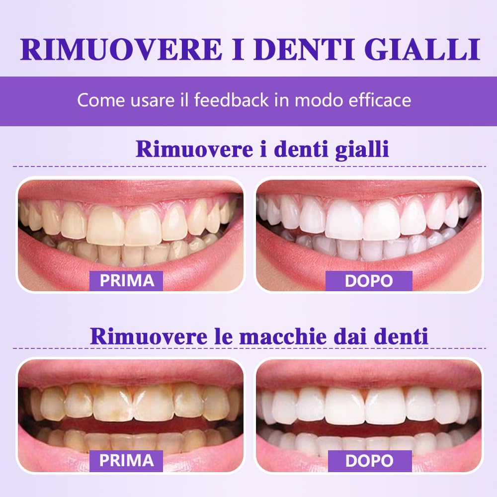 Polvere Sbiancante Denti,Dentifricio Sbiancante Professionale,Sicuro per lo Smalto,Pulizia Profonda e Sbiancamento Denti,Rimuove Macchie e Freschezza Orale