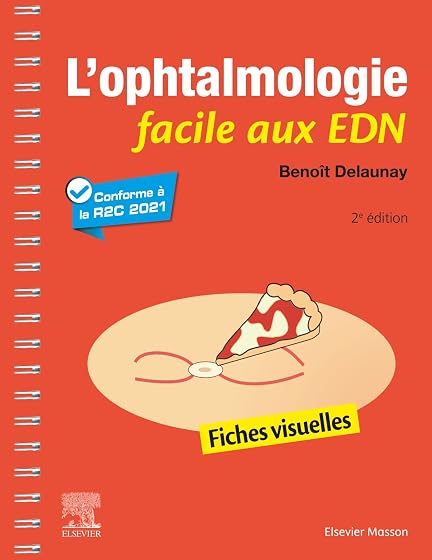 L'ophtalmologie facile aux EDN: Fiches visuelles
