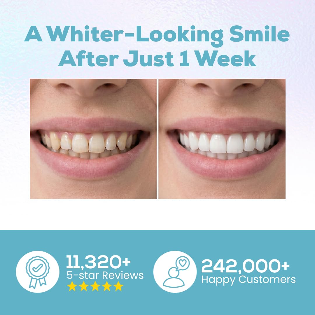 Venus Visage Teeth Whitening Pen - Whiten Teeth Fast -2