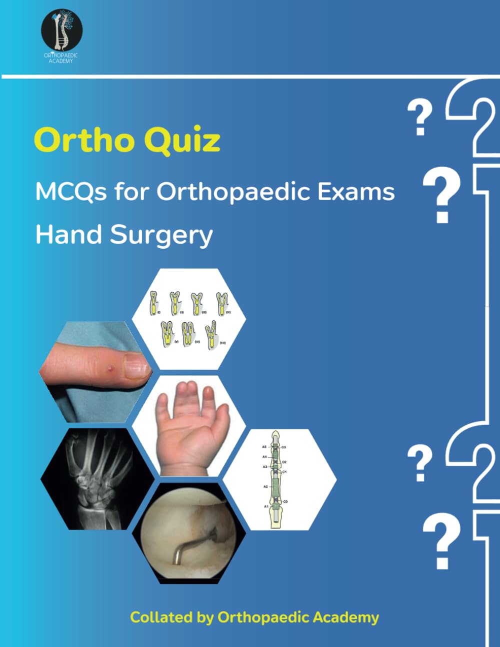 OrthoQuiz: Hand MCQs (Concise Orthopaedics)
