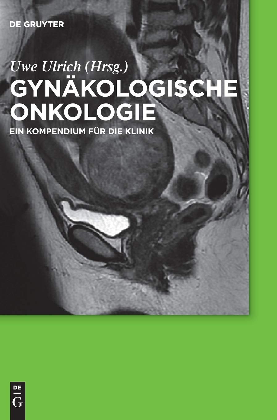 Gynäkologische Onkologie: Ein Kompendium für die Klinik