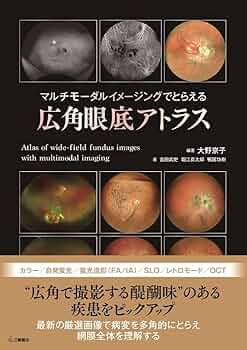 広角眼底アトラス 61RvhKjRthL._AC_UF350,