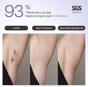 Ulike Air 3 Deluxe IPL Devices Hair Removal for Face and Body at Home Alternative to Laser Hair Removal Sapphire Ice Cool for Permanent Hair Removal with UV Steriliser & Aloe Gel Purple