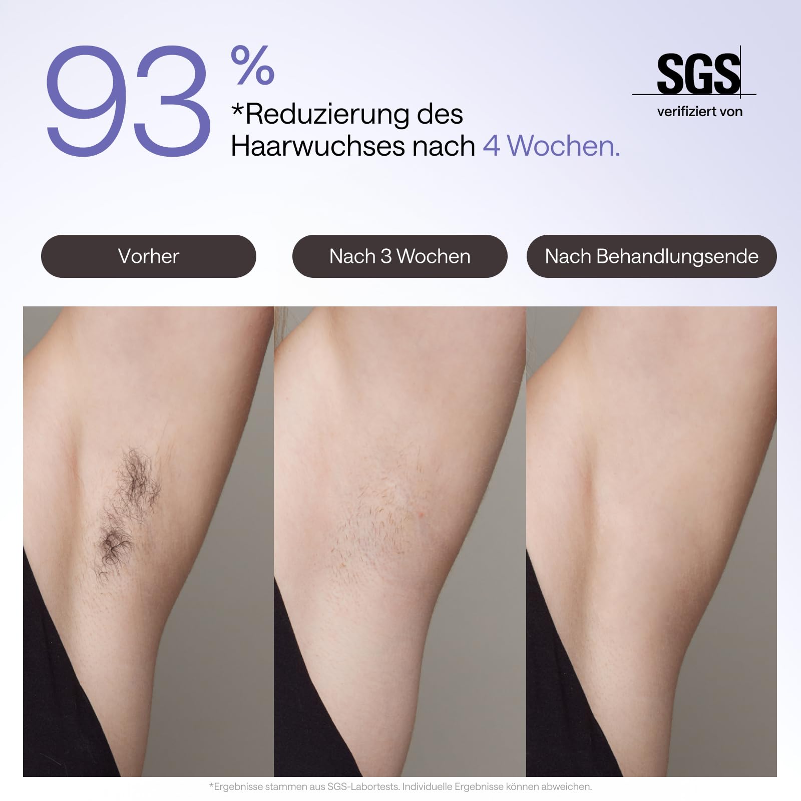 Ulike Air 3 Deluxe IPL Gerät Haarentfernung für Gesicht und Körper, Saphir-Eiskühl, UV-Sterilisator, Aloe Gel, Lila