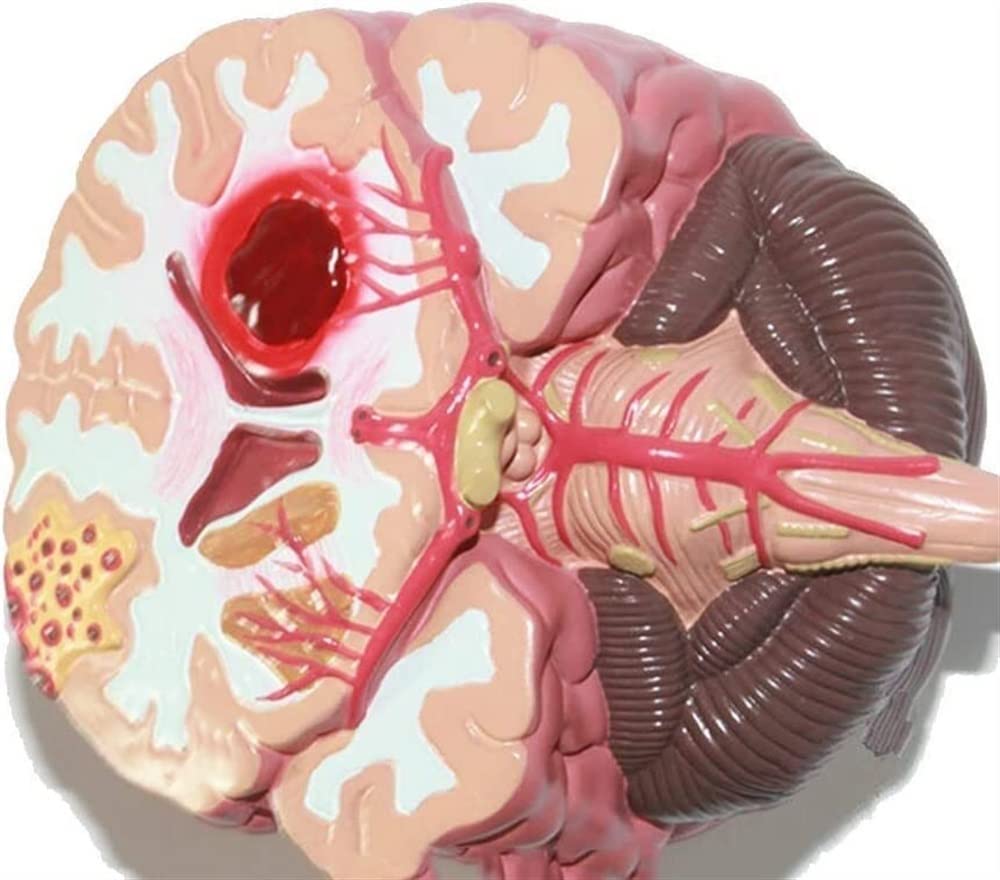 Tryb Nauczania Anatomii, Tryb Montażu Chorób Mózgu Ludzkiego, Tryb Anatomii Neurochirurgii, Tryb Nauczania Patologii Krwotoków Mózgowych