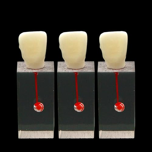 10PCS Modelo Dental Endodóntico Bloque de conducto radicular Práctica Pulpa Cavidad Resina Transparente Estudio Endo Entrenamiento Diente RCT Demo