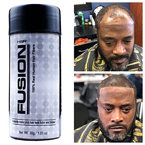 Best Hair Thinning Spray 10Reviewz