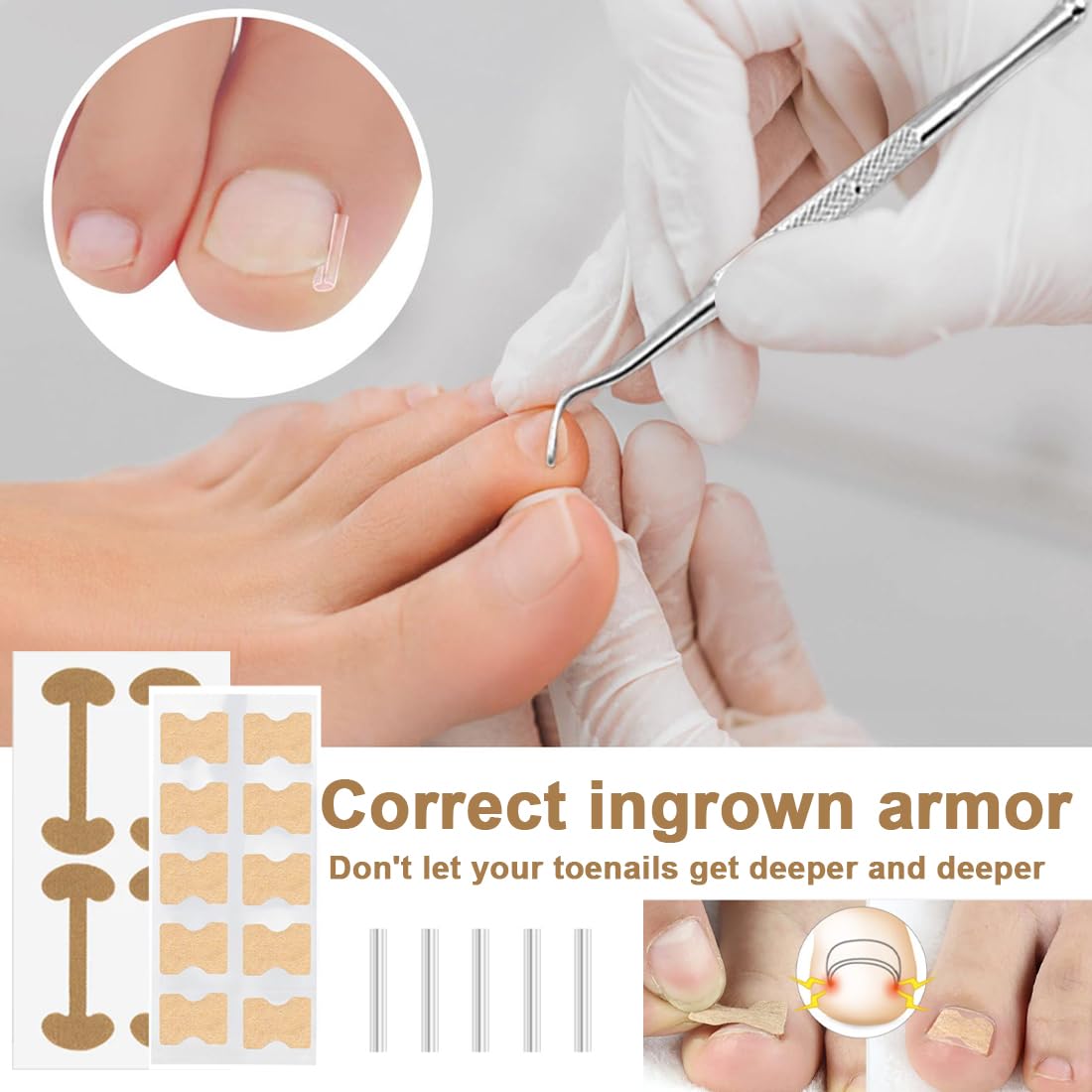 Set di unghie Incarneato, Correttore Unghie Incarnite Piedi, Soluzione Completa per Unghie dei Piedi Incarnite, Traspiranti Cerotti Per Unghie, Cuscinetti Di C Per Unghie Incarnite Piedi
