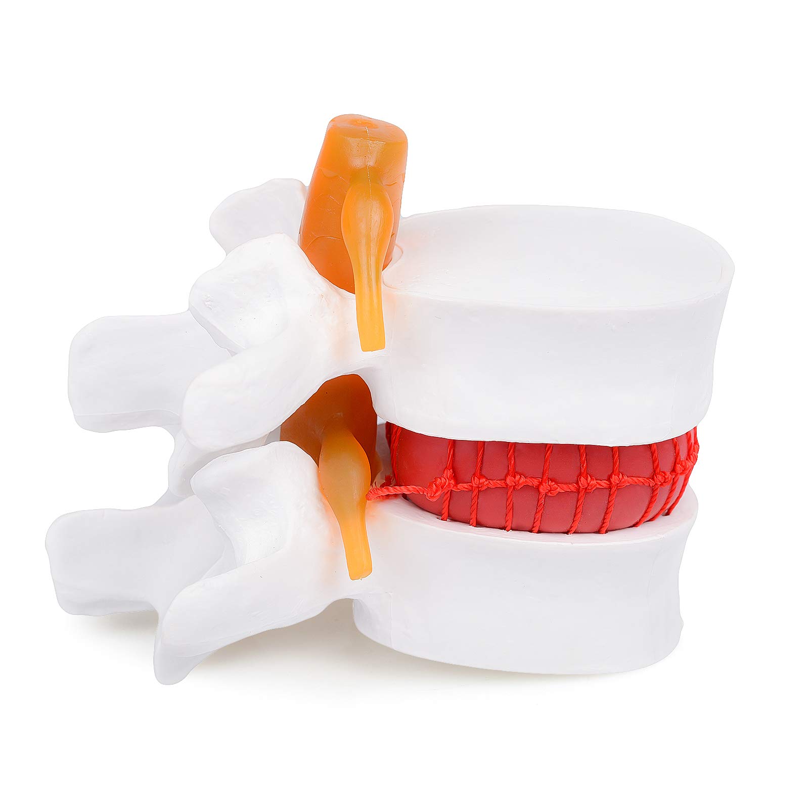 White Calla Scorpio 1:1.5 Size Magnification Human Lumbar Spine Vertebrae Degenerative Disc Anatomical Model