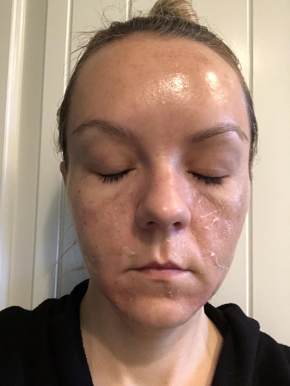 TCATherapyCare Solution Acid Peel 40% (Livello 2 pH 1.9) - Esfoliante, texture e tono della pelle - peeling viso - 30 ml con neutralizzatore (100 ml)