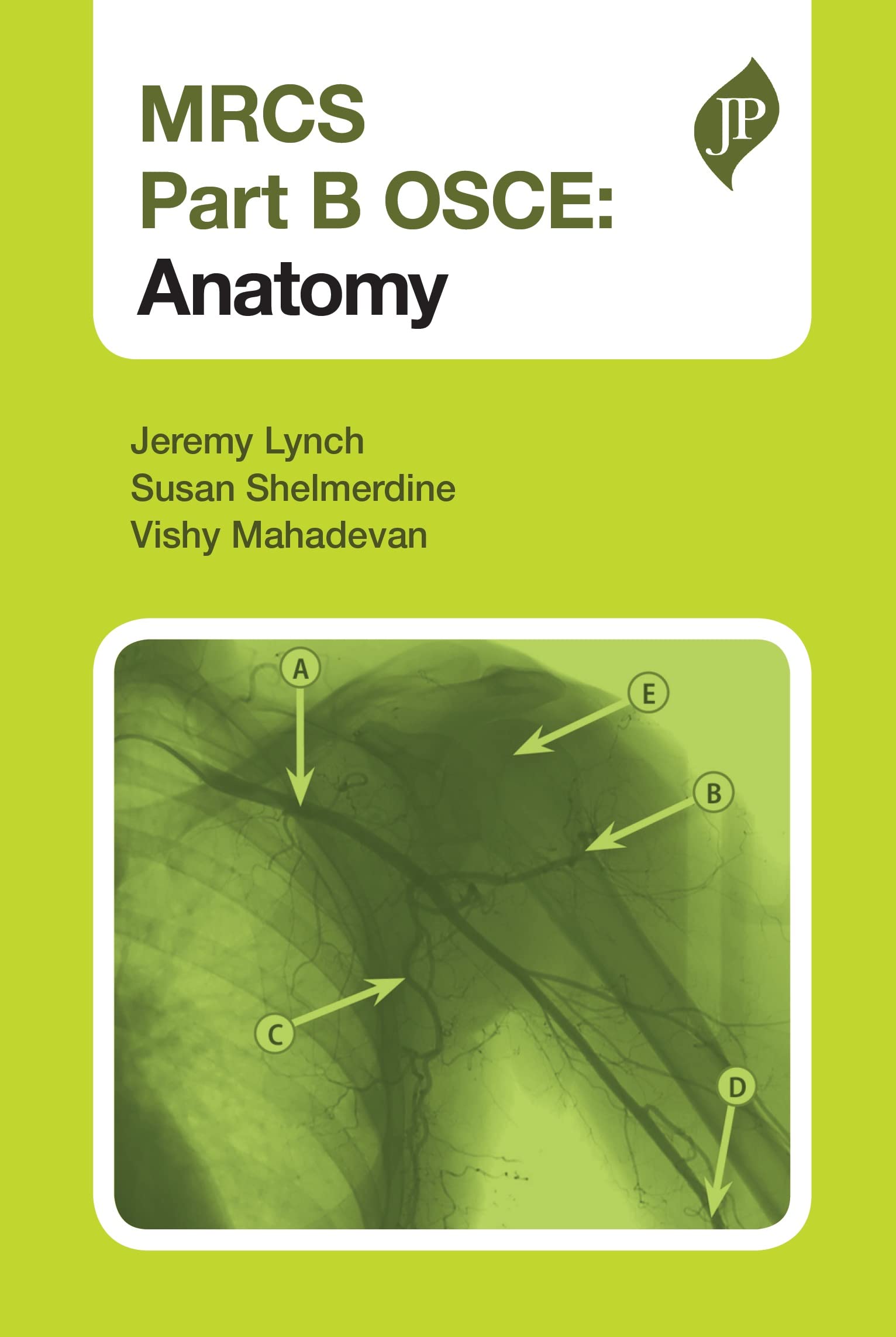 MRCS Part B OSCE: Anatomy Paperback – 2 Jan. 2013