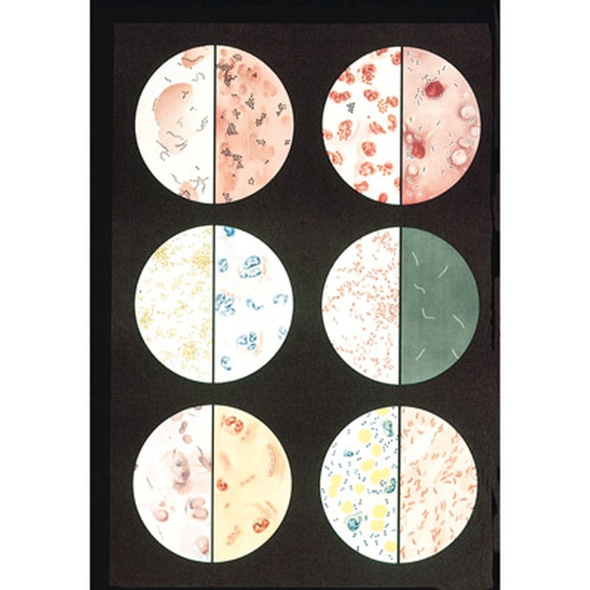 3B Scientific Human Anatomy - Bacteria Chart with wooden rods