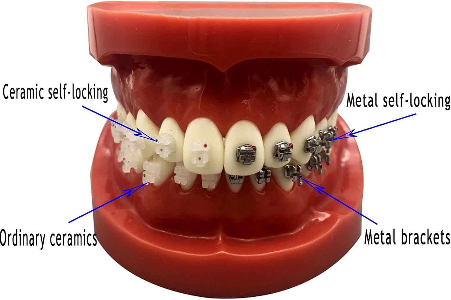 Model Dentystyczny Duplikat Formy, Model Ortodoncji, Model Dentystyczny Cztery Modele Porównawcze Zamków, Trwały Model Standardowy Badania Nauczania Dla Laboratorium
