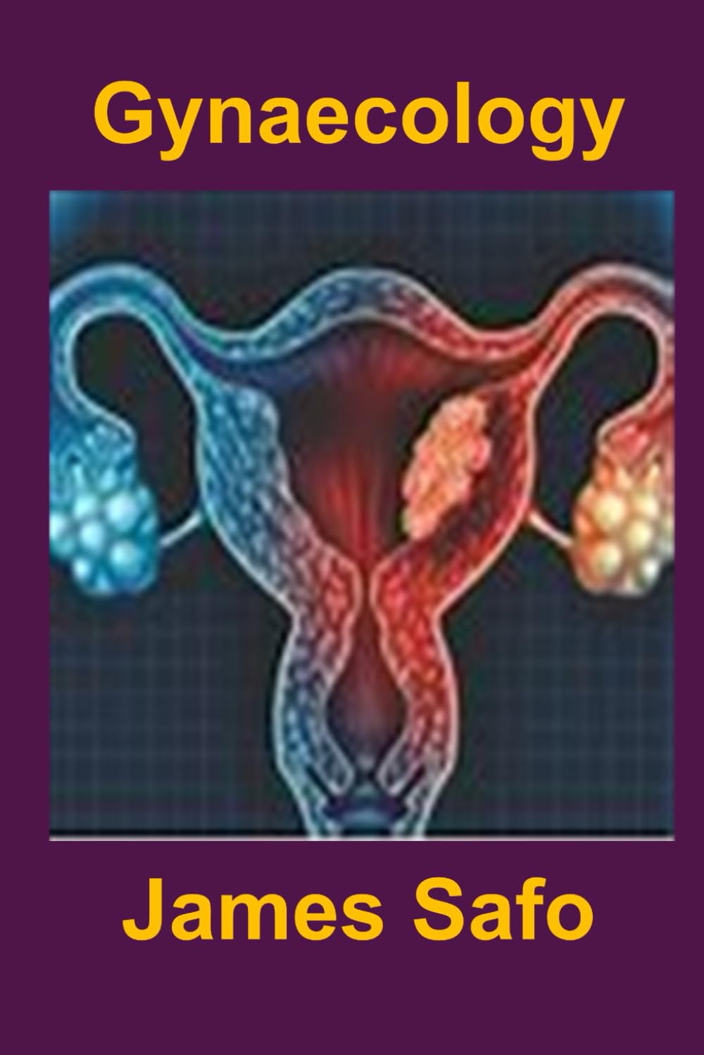 Gynaecology