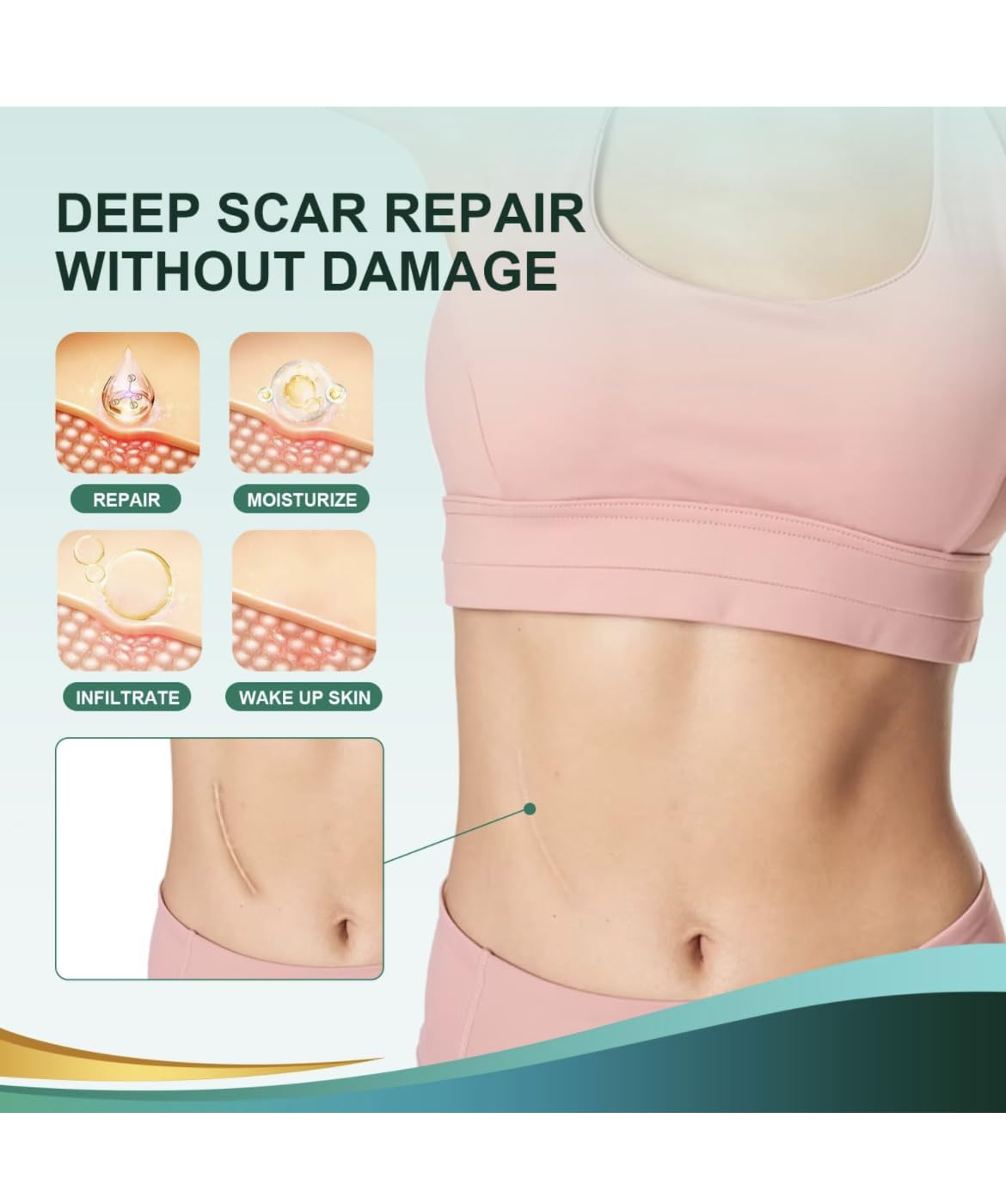 Silicone Scar Tape - Medical Grade Silicone Scar Sheets, 1” X 120”, 2-Pack - Professional Scar Removal Treatment for Keloid, C-Section, Surgery, Wrinkles - Reusable Scar Tape Strip - Image 7