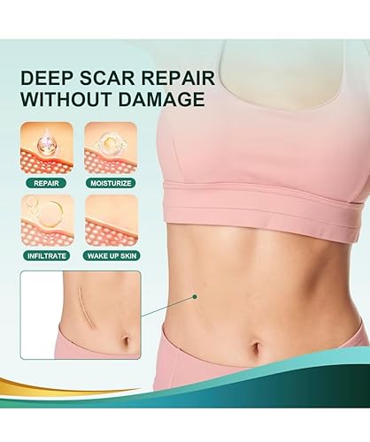 Miniatura 7 de Cinta de silicona para cicatrices, hojas de silicona de grado médico, 1 x 120 pulgadas, paquete de 2  Tratamiento profesional de eliminación de