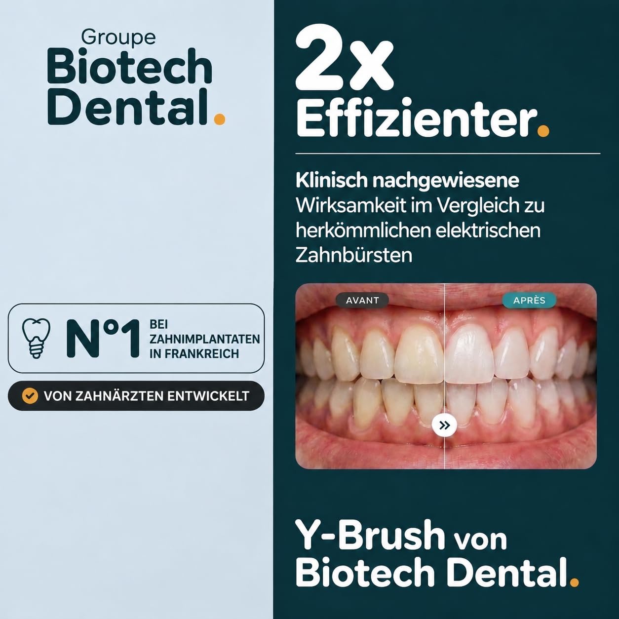 Elektrische Zahnbürste Y-Brush Ultra Premium – Premium-Set | 6 Monate Akku | 2× effizienter | Biotech Dental, führend in Europa | Premium-Set | 6 Modi | Aufhellung