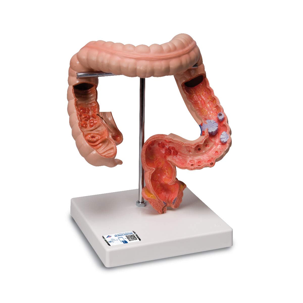 3B Scientific Dickdarm-Modell, K55