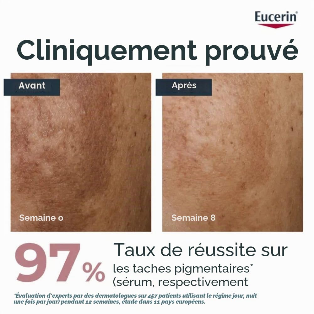 Eucerin Anti-Pigment Dual Serum, 30 ml Solution | Réduit visiblement les taches pigmentaires, donne un teint uniforme de la peau, avec du thiamidol et de l'acide hyaluronique