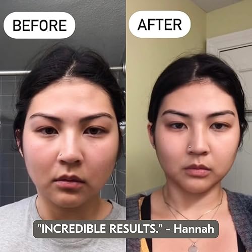 Miniatura 2 de Mount Lai - The Jade Trio Balancing Set  Jade Roller and Gua Sha Set  Gua Sha Tools to Relieve Muscle Tension and Reduce Puffiness  Anti Aging Skin