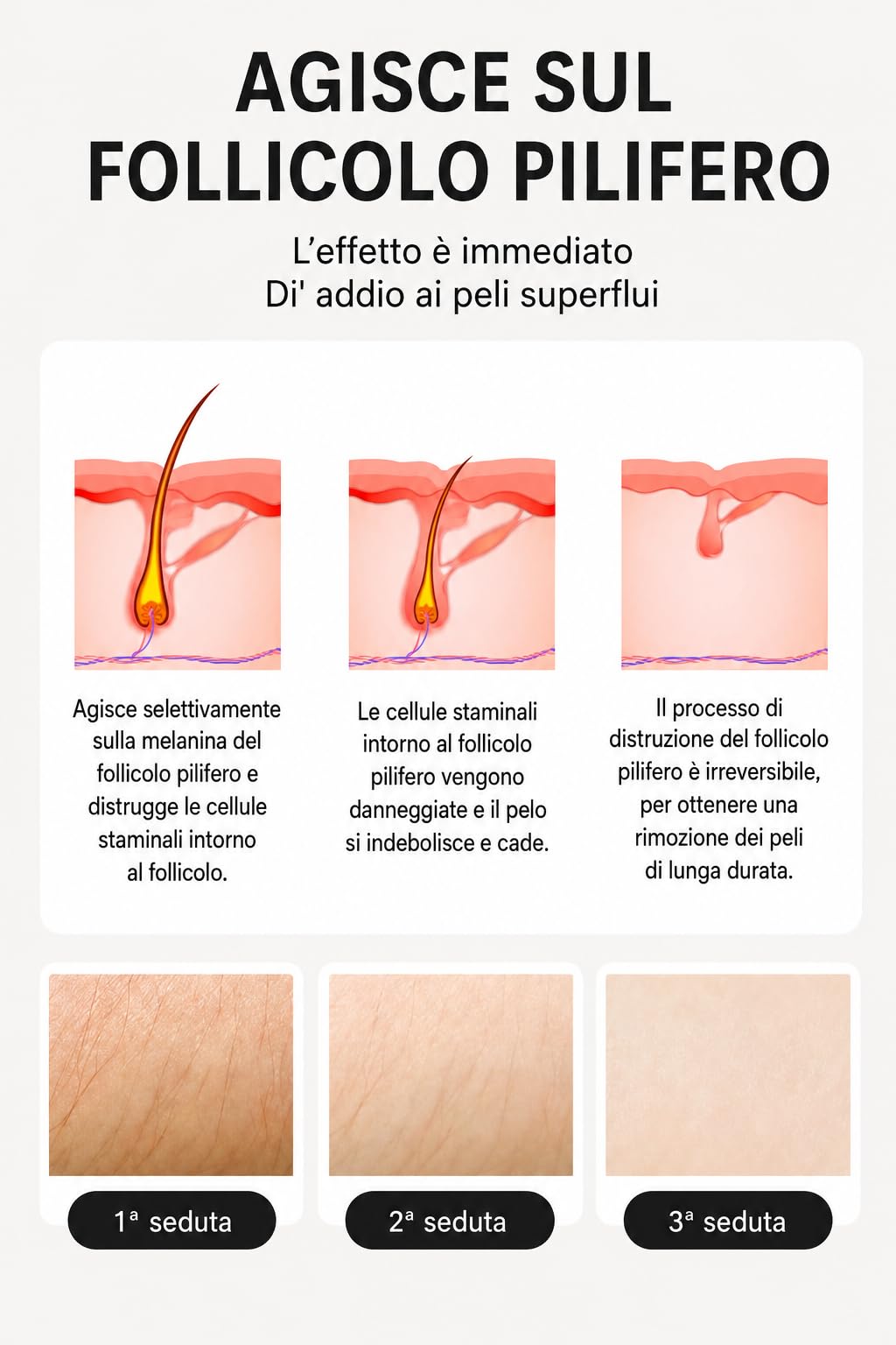 Dispositivo per epilazione laser a diodo 808 nm nero, manipolo con 10 barre laser, lunghezze d onda 755 808 1064 nm, raffreddamento integrato, display touch HD, per salone spa e casa