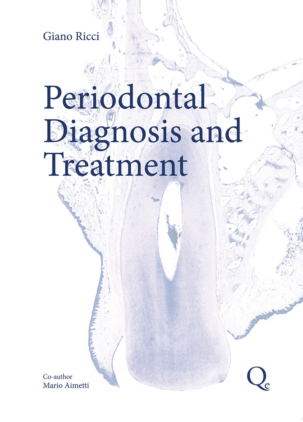 Buy PERIODONTAL DIAGNOSIS AND THERAPY (HB 2014) Book Online at Low