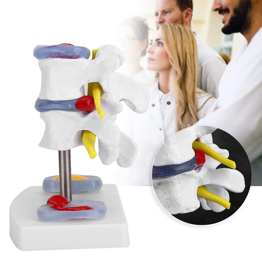 Menschliches Lendenwirbelmodell, menschliches anatomisches Skelettmodell Lendenwirbelmodell mit abnehmbarer Basis Einfach zu installieren Helfen Sie Menschen, den Zustand der Wirbelsäule zu überwachen